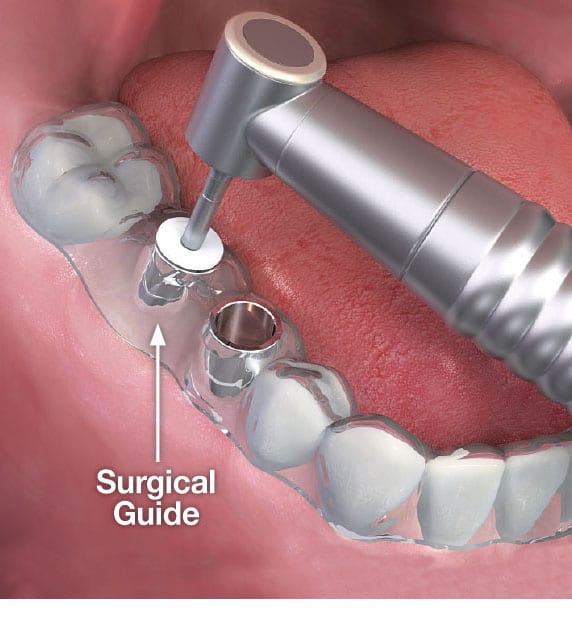 South Barrington IL Dentist